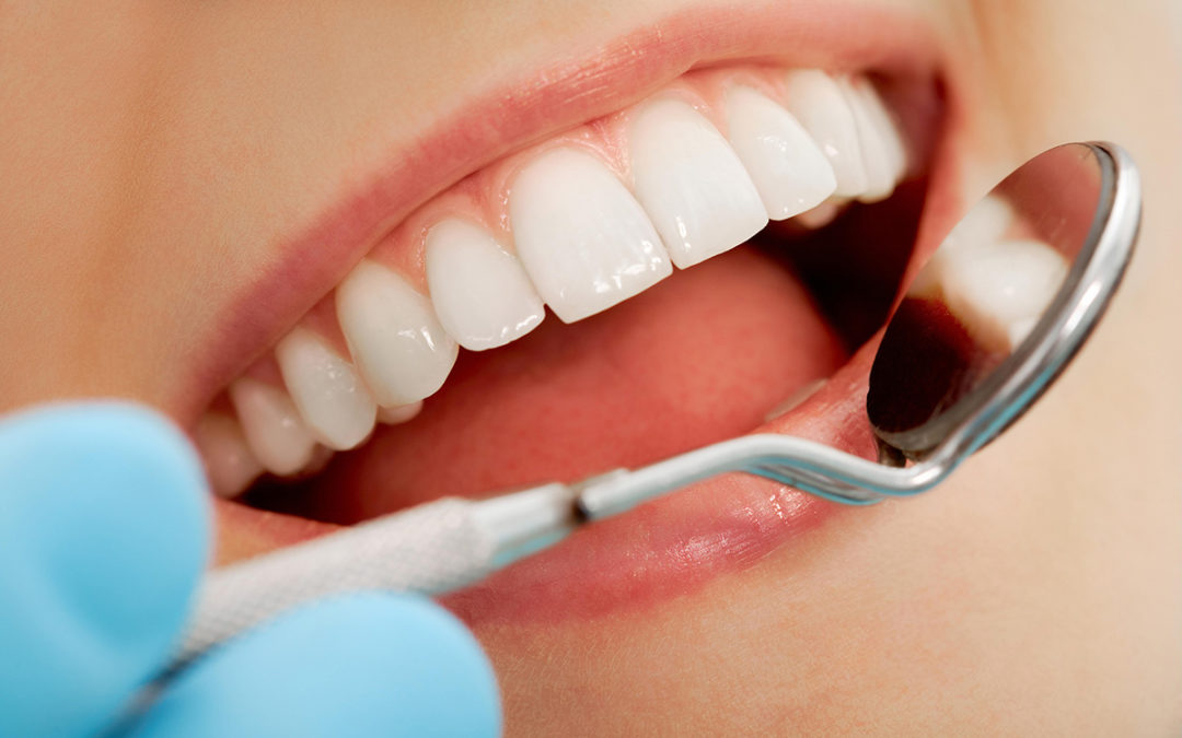 Anxiety-at-the-Dentist-1080×675