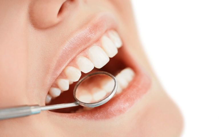 dental-fillings-1080×675 San Francisco dentist inspecting mouth before dental filling