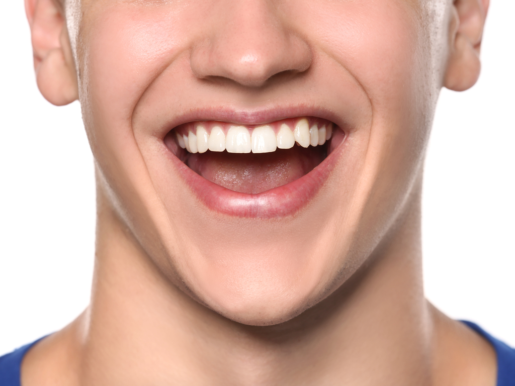 A young man smiling with straight, white teeth.