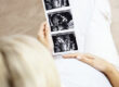 Pregnant woman holding a sonogram of their unborn child.
