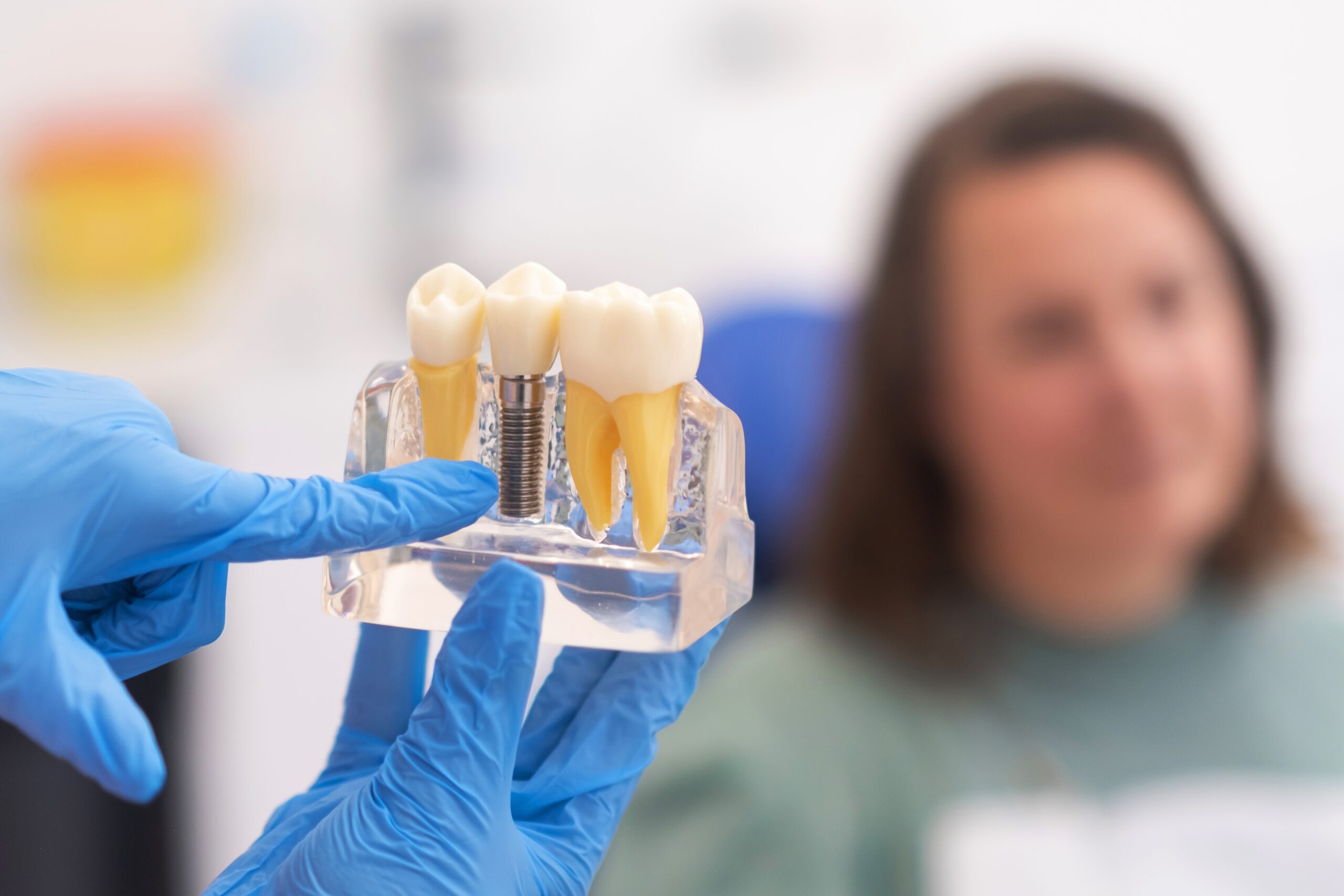 dentist in blue gloves sowing a female patient an implant model