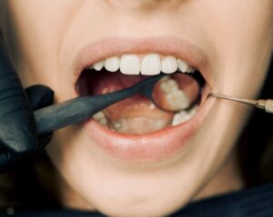 What Your Gums Can Reveal About Your Body