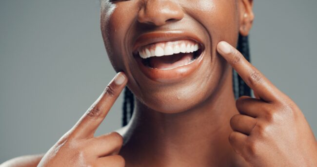 Teeth,,Dental,Wellness,And,Woman,Point,At,Mouth,For,Oral cropped smile, perfect white teeth