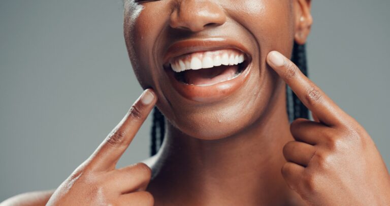 cropped smile, perfect white teeth